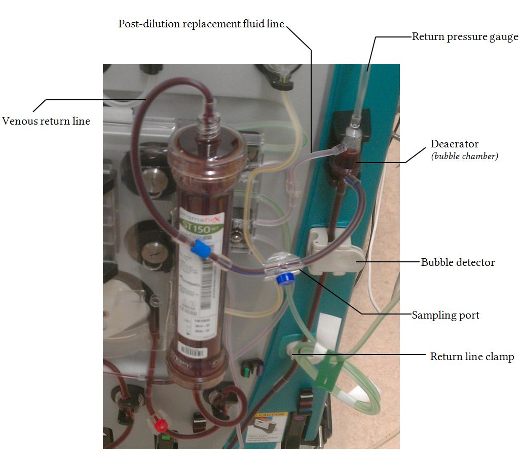 Anatomy of the extracorporeal dialysis circuit Deranged Physiology